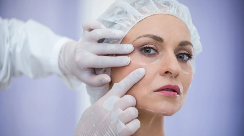 Why Women Over 40 Are Switching to Sculptra & Ditching the Frozen Look for Good