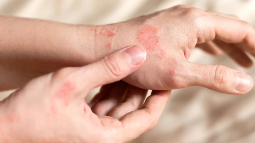 Amoxicillin (Generic Amoxil): Trusted Antibiotic for Bacterial Infections Worldwide