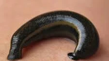 Finding Safe and Best Leech Treatment in Mumbai Clinics