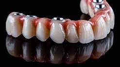 Complete Dental: Expert Smiles for Kids, Confident Smiles for Life!
