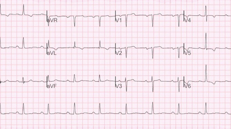 Patient Preparation for ECG: What Students Must Know