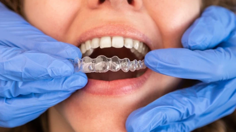 How to Care for Your Teeth During Invisalign Treatment