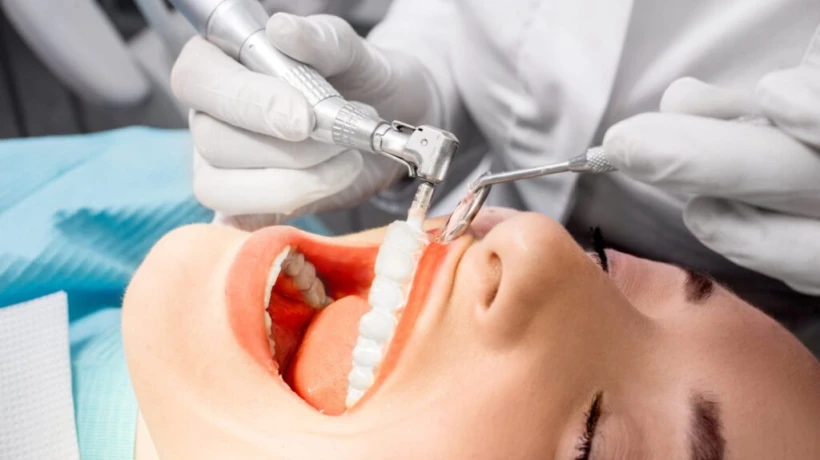 Signs You Need Teeth Cleaning for Better Oral Care