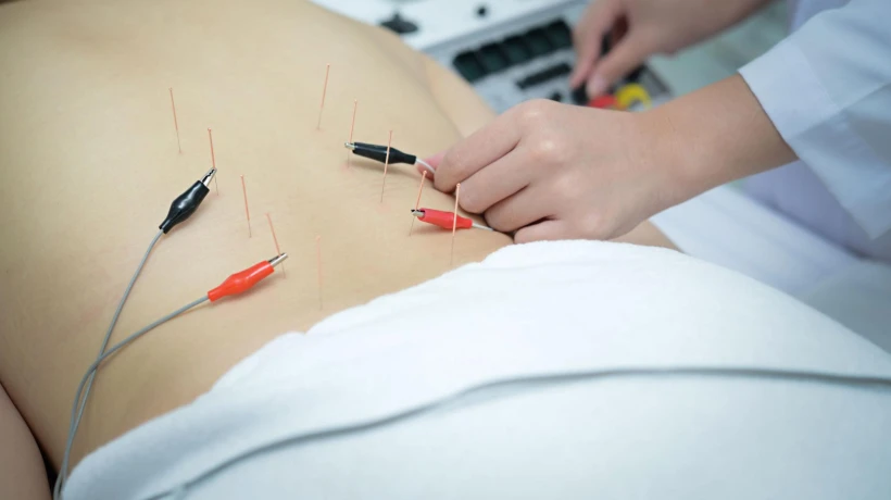 The Ultimate Guide to SkinPen Microneedling in San Francisco, Benefits, Process and Results