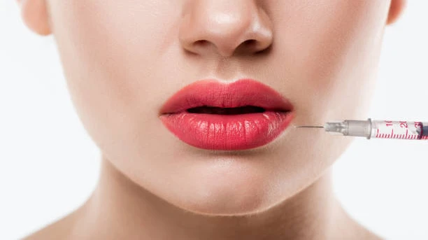 Can Lip Flip Help You Achieve a Perfect Smile Line?