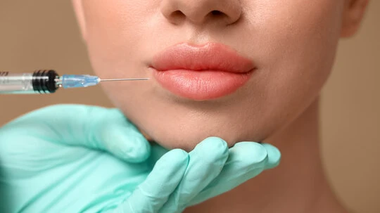 How Does Lip Flip Enhance Thin Upper Lip Shape?
