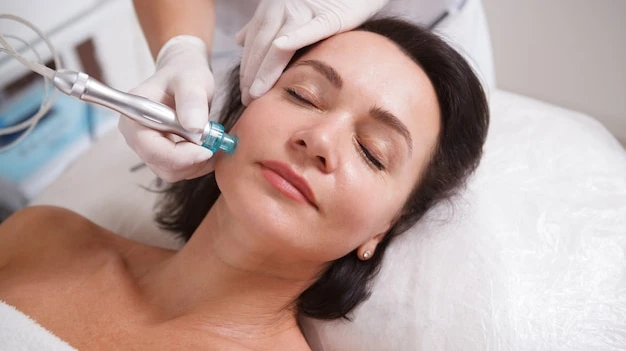 How Does HydraFacial Polish Skin for a Smoother Look?