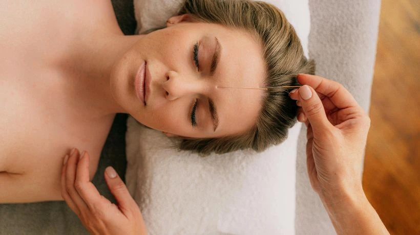 Cosmetic Acupuncture vs. Botox: Why More San Francisco Women Are Making the Switch