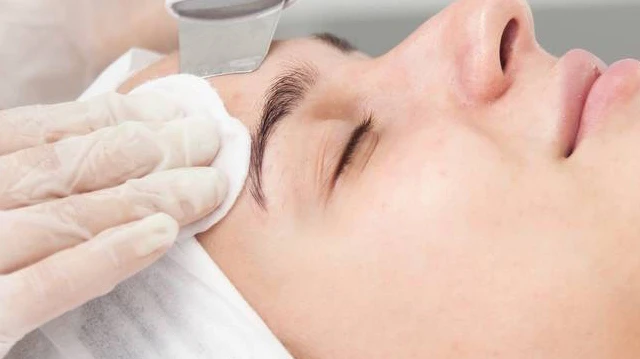 How Many Sessions of Skin Resurfacing Are Usually Needed?