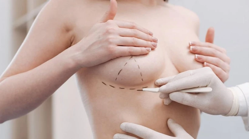 Breast Lift Surgery Cost for Different Age Groups