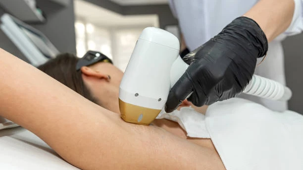 What Areas Can Be Treated With Laser Hair Removal?