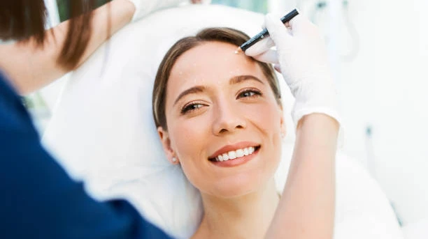 Plasma Pen Treatment in Dubai for Forehead Lines & Wrinkles