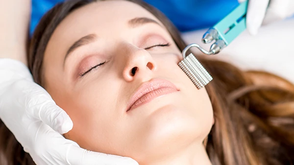 Can Microneedling Improve Deep and Old Scar Appearance?