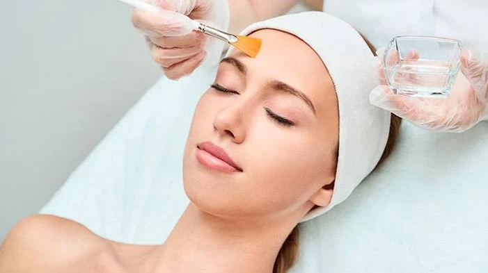 What Results Can You Expect From Chemical Peels for Acne Scars?