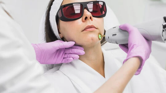 Why Is Laser Hair Removal Popular for Facial Hair Removal?