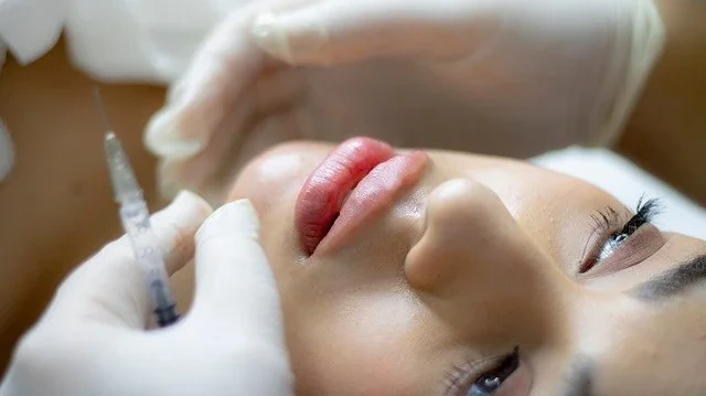 Dermal Fillers During Ramadan: Safety and Rules