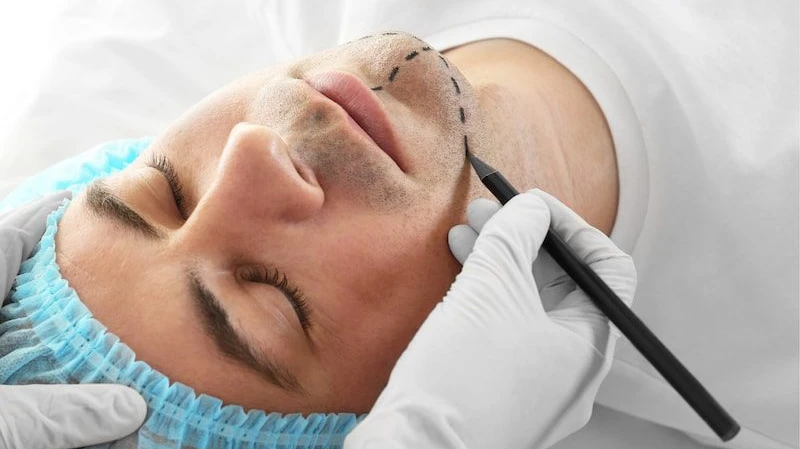 Can Endolift improve collagen and elastin production?