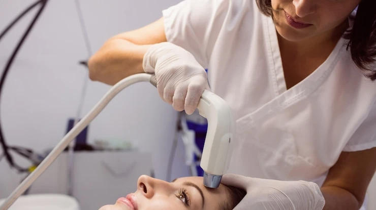 How Does Pico Laser for Face Pigmentation Target Melanin?