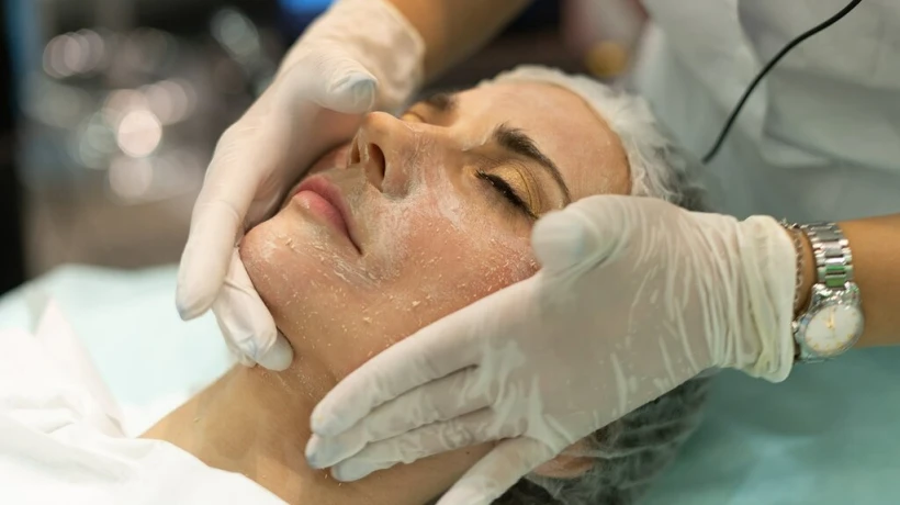 How Can Cosmelan Peel Reduce Skin Discoloration?