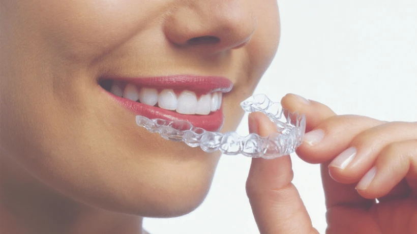 Best Dental Implant Surgeon in Bikaner for Safe and Advanced Smile Restoration