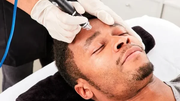 How Does HydraFacial Remove Impurities From the Skin?