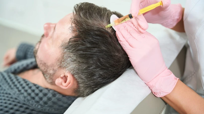 Why PRP Treatment Is Trending in Hair Regrowth?