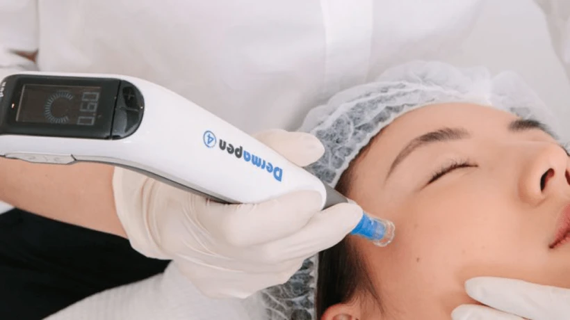 Can Dermapen Microneedling help with uneven skin tone?