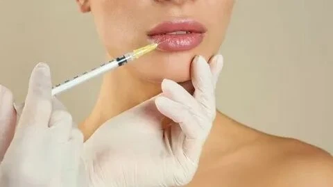How Soon Can You See Results From Lip Fillers?
