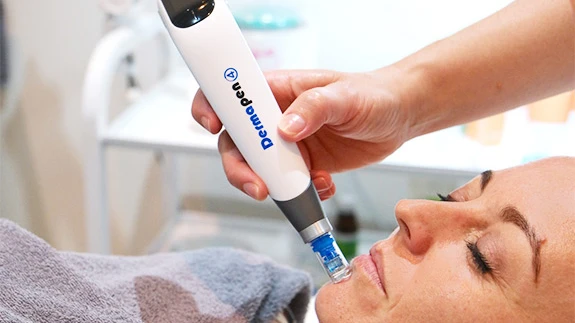 What Skin Concerns Can Dermapen Microneedling Address?
