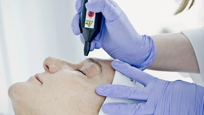 What Areas Can Plasma Pen Treatment Improve?