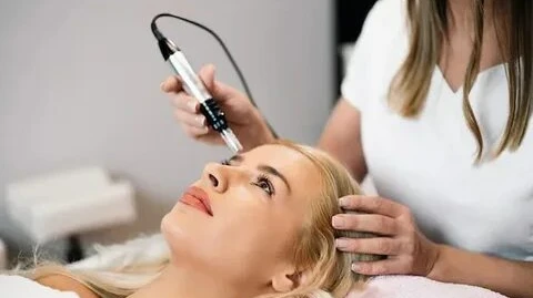 Does Microneedling Treatment Help With Stretch Marks?