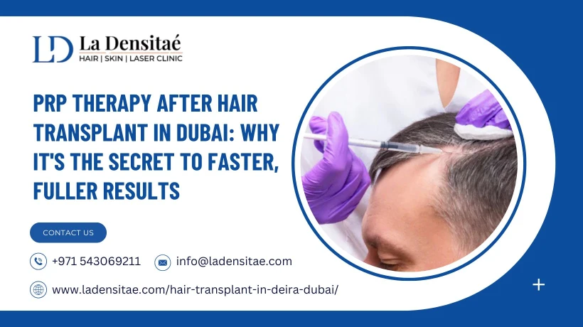 PRP Therapy After Hair Transplant in Dubai: Why It's the Secret to Faster, Fuller Results