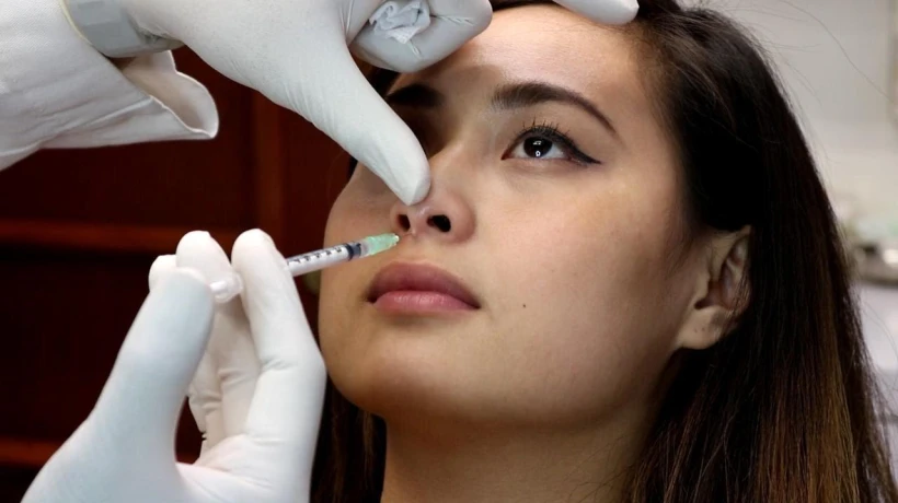 How Much Change Can Nose Fillers Make to the Nose Shape?