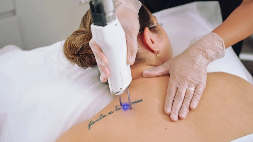 Does laser tattoo removal work on all skin types?