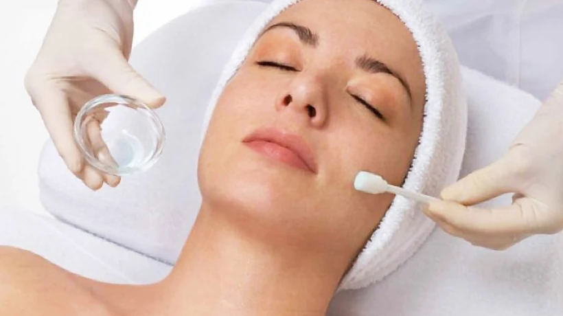 Does Chemical Peel Remove Dead Skin Cells Safely?