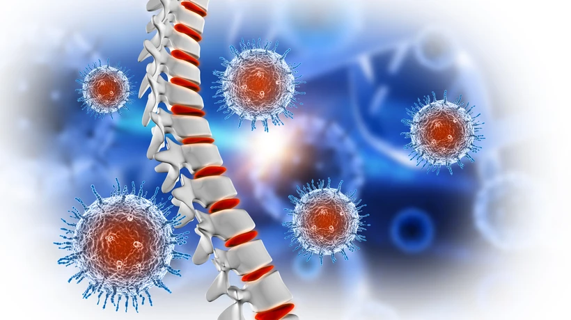 Bone Cancer: Causes, Symptoms, and Treatment Options