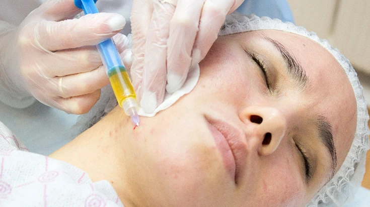Is Vampire Facial Good for Uneven Skin Texture?