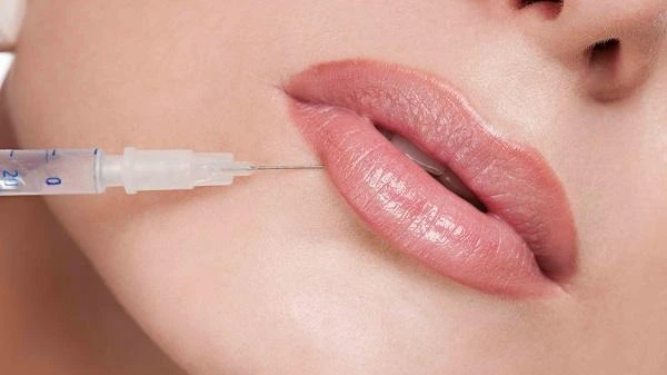 Why Enfield Royal Clinic Is a Trusted Choice for Russian Lips