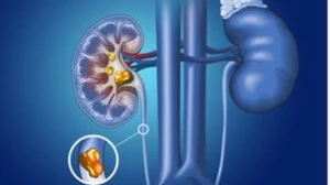 How Do Unhealthy Food and Lifestyle Habits Affect Your Liver?
