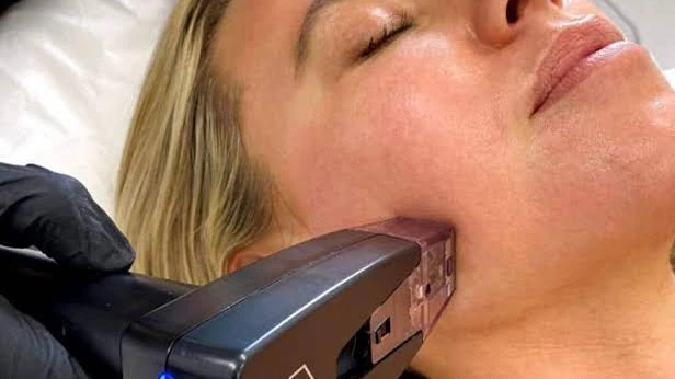 Is Morpheus8 Suitable When Your Skin Looks Older Than You Feel?