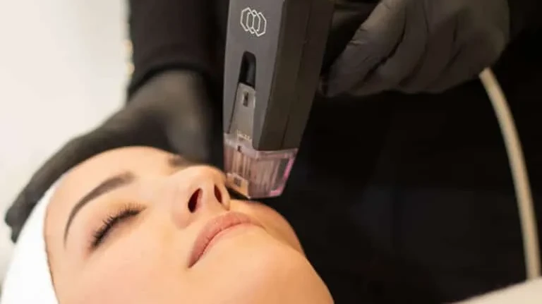 Can Morpheus8 Reduce Visible Signs of Ageing?