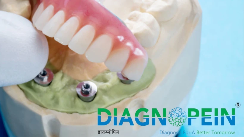 Top Dental Clinic In Nagpur for Healthy Teeth & Bright Smiles