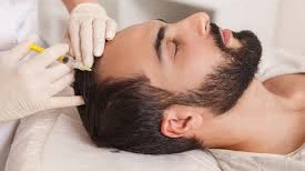 Hair Loss Treatment in Riyadh with Expert Insights on Hair Restoration
