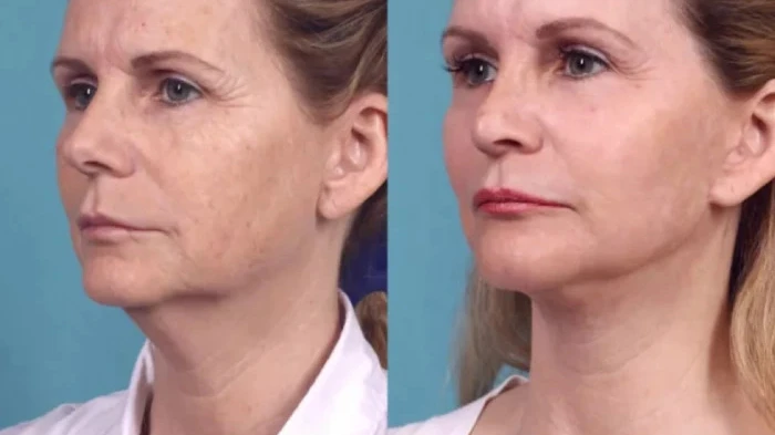 Best Plastic Surgeons in Dubai for Facial Beauty Enhancement