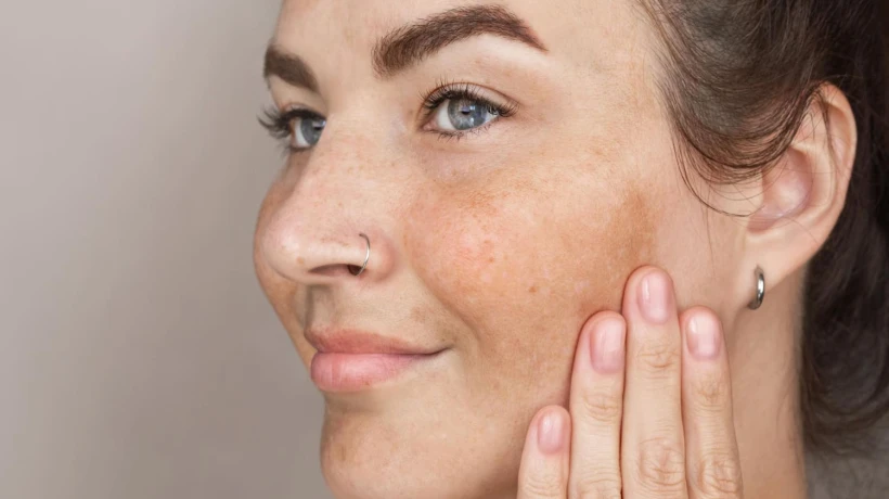 Can Best Pigmentation Treatment Help With Pigmentation as You Age?