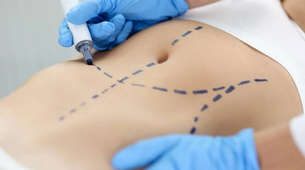 Fat Melting Injections for Creating More Noticeable Body Definition