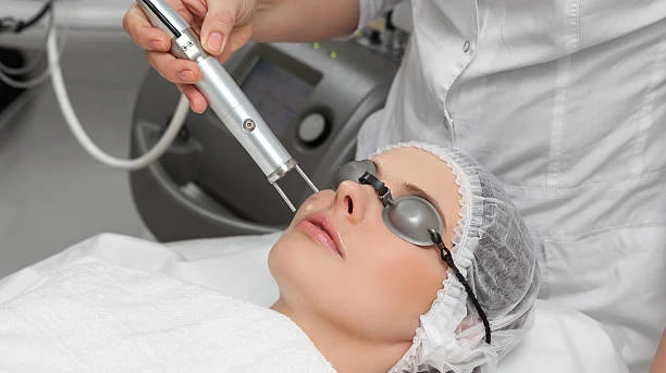 Is Laser Hair Removal Safe for Acne-Prone Skin Types