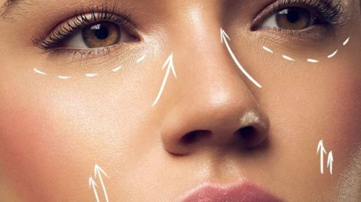 Facelift Surgery for Addressing Jowls, Loose Skin, and Facial Sagging