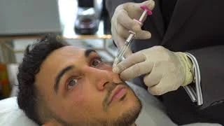 What Should You Look for in a Dark Circles Treatment?