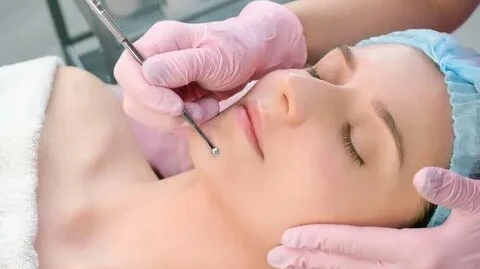 Can Electrolysis remove fine and light-colored hairs